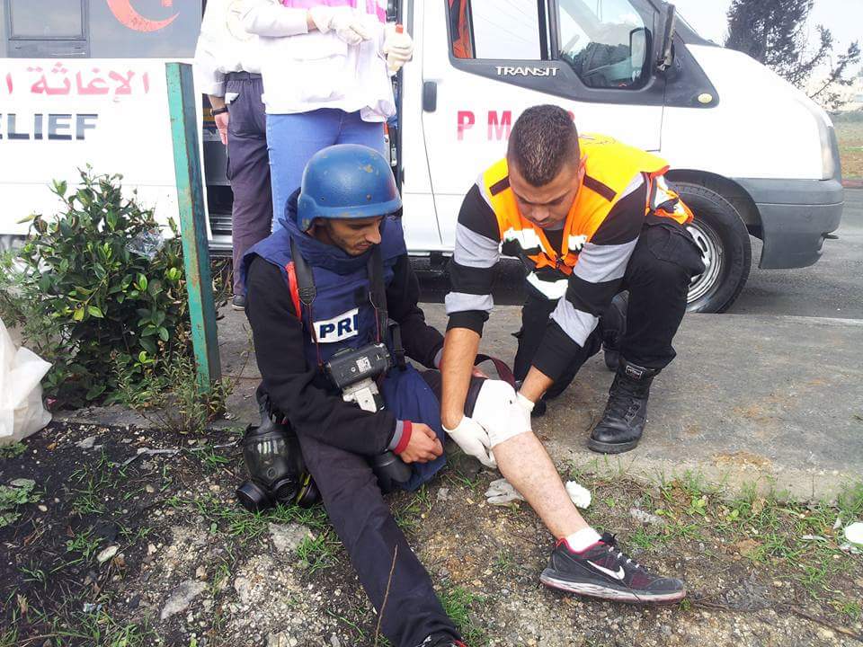 إصابة 3 مواطنين بينهم صحفي شمال البيرة صورة المصاب