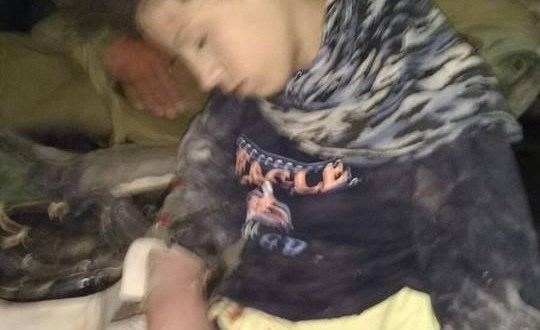 تمديد اعتقال الطفلة الجريحة استبرق نور غيابياً صورة الطفلة