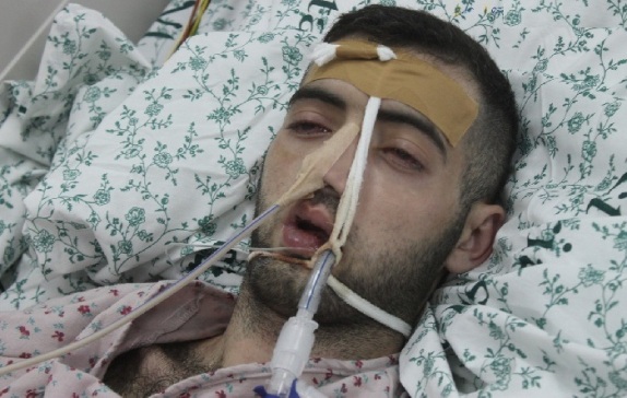 نقل المحرر عوض إلى العناية المكثفة جعفر عوض