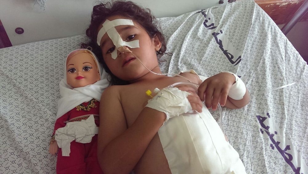 طفلة مصابة خلال الحرب غزة الأخيرة