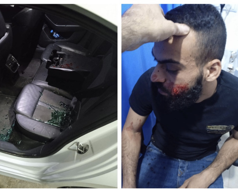 إصابة شاب في هجوم للمستوطنين على مركبات المواطنين غرب رام الله