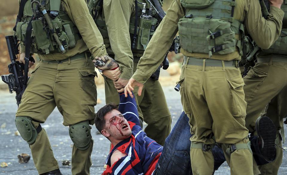 اليوم: 272 جريحًا في الضفة تصوير: بهاء نصر