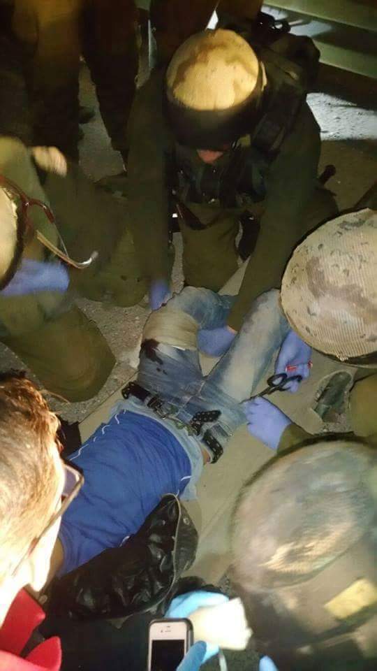 حزما: إصابة طفل برصاص الاحتلال