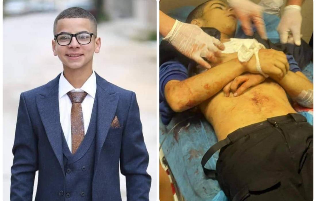 استشهاد فتى برصاص الاحتلال خلال اقتحام قبر يوسف بنابلس