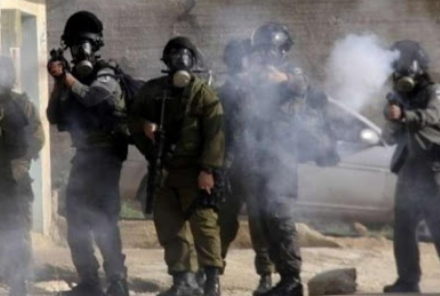 طولكرم: اصابة العشرات بحالات اختناق خلال مواجهات مع الاحتلال