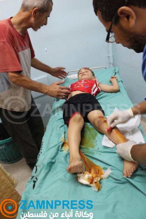 أطباء وحقوقيون: إسرائيل تستهدف مدنيي غزة بأسلحة محرّمة دولياً