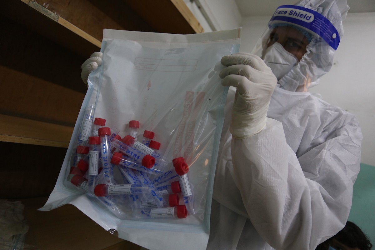 85 اصابة جديدة بفيروس كورونا في غزة