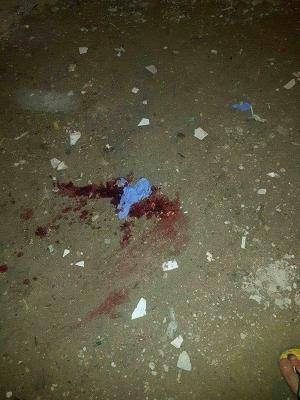 معاريف: إصابة جندي بجروخ خلال اقتحام مخيم جنين