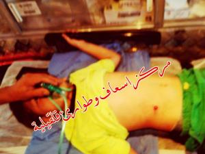 اصابة طفل