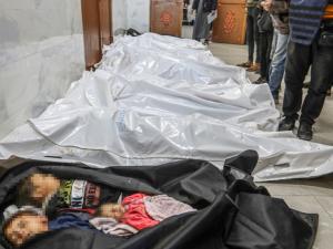 مزيد من الشهداء بسبب “التجويع” في غزة.. ووزارة الصحة تكشف عن حصيلة جديدة لضحايا العدوان