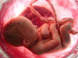 دراسة تكشف عدد حالات الإجهاض السنوية في أنحاء العالم