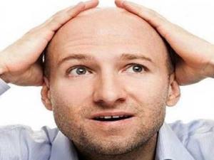 علاج تساقط الشعر 