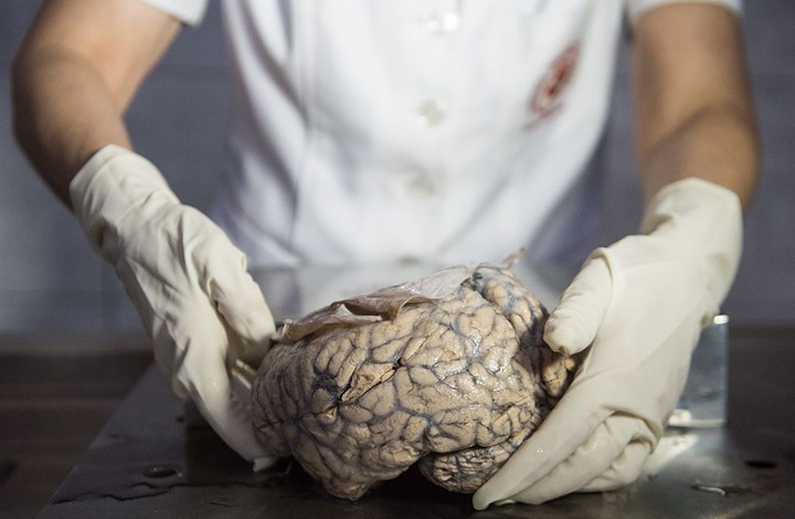 لأول مرة.. علماء يستيطعون زراعة دماغ بشري مخبريا