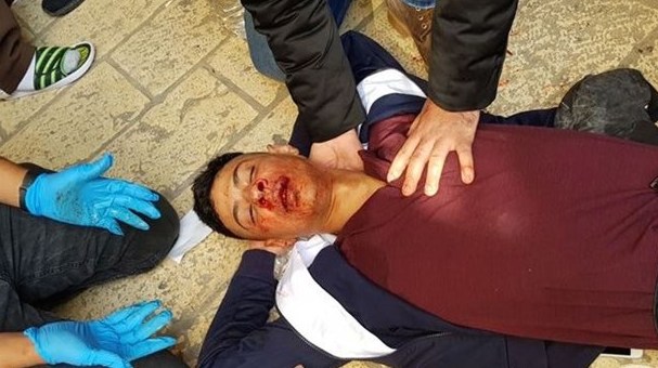 مستوطنون ينهالون بالضرب المبرح على مقدسي