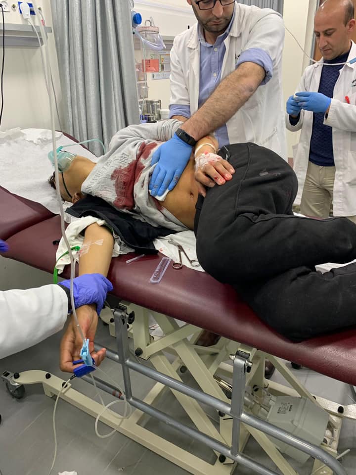 اصابة طفل بجراح خطيرة برصاص الاحتلال بمخيم شعفاط بالقدس المحتلة