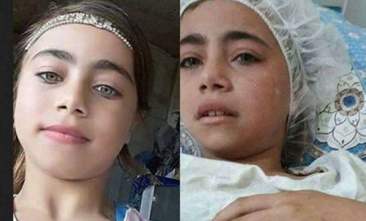 الاحتلال يسمح لوالدة الطفلة انعام بمرافقتها