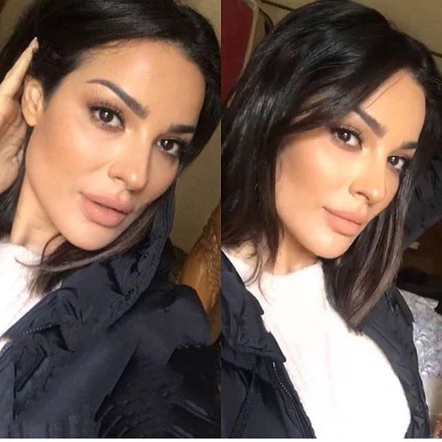 رسالة قاسية من نادين نجيم إلى منتقدي عملية تجميل فكها!