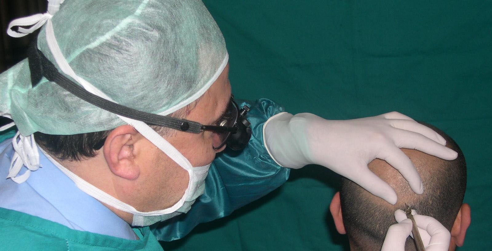 تركيا تجني مليار دولار في 2018 من زراعات الشعر