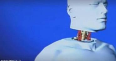 تغيير كبير في أول عملية زراعة رأس بالعالم